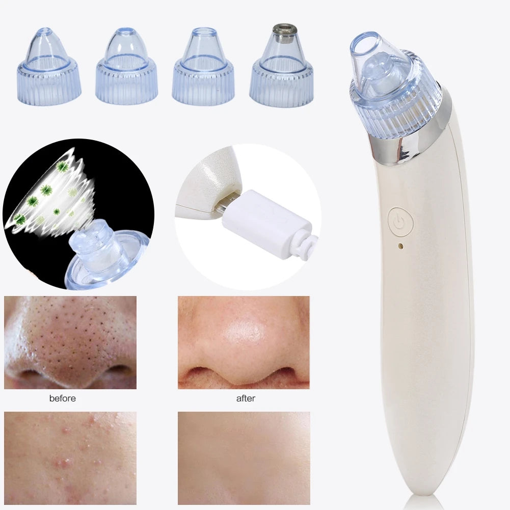 Electric Skin Pore Cleaner Acne Pimple Nose Blackhead Suction Remover Beauty Machine Rose Gold